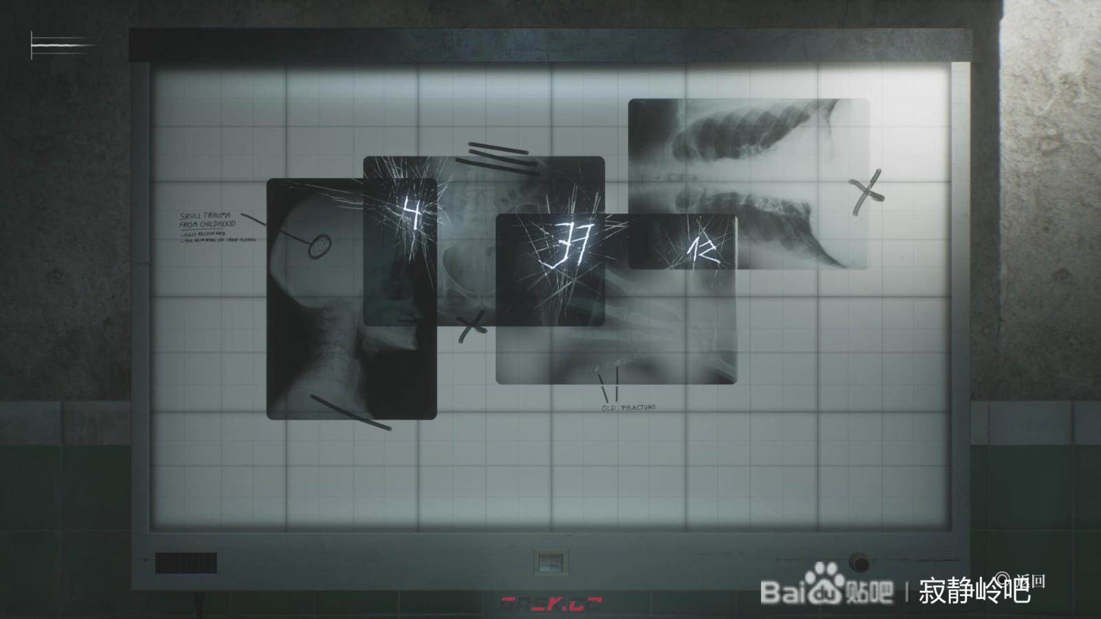 《寂静岭2：重制版》医院密码线索分享-第7张-单机攻略-GASK