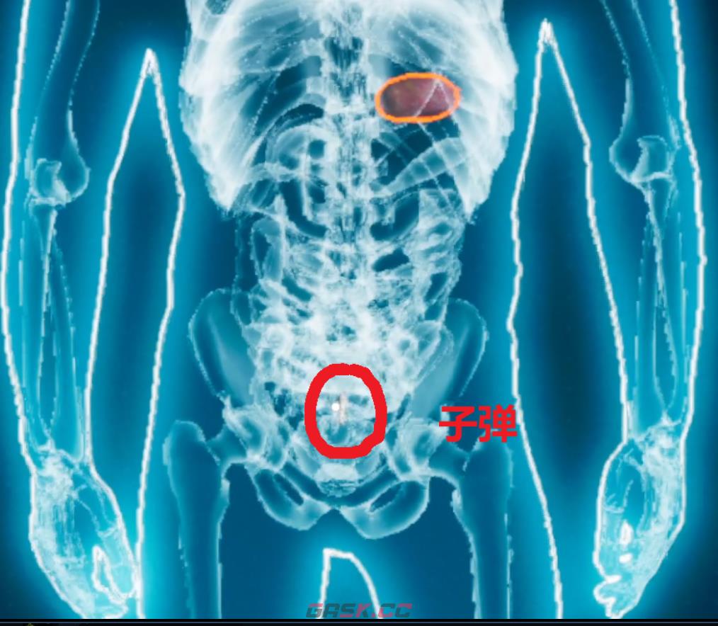 《检疫区：最后一站》皮下之物成就攻略分享-第3张-单机攻略-GASK