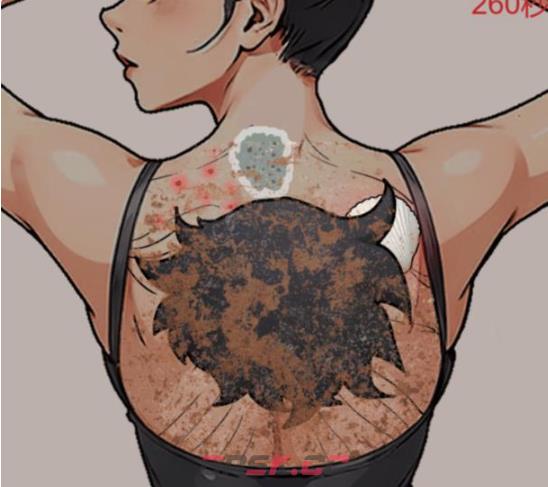《解压找茬烧脑》第234关背部护理通关攻略-第2张-手游攻略-GASK